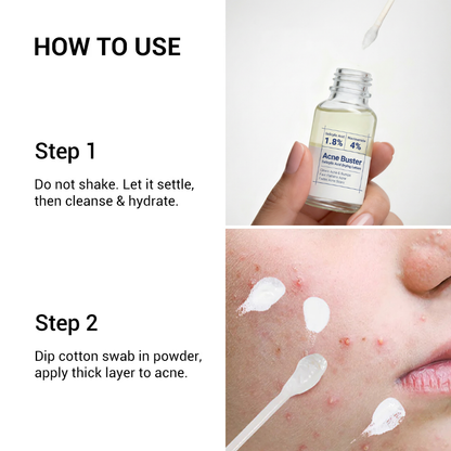 Clear Acne Overnight (Without Harsh Chemicals)